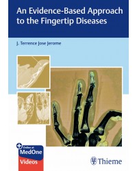 An Evidence-Based Approach To The Fingertip Diseases